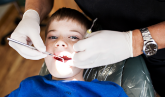 Pediatric Dental Benefits