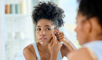 It’s the night before a job interview and you discover a huge pimple on your nose. You reach for the toothpaste, following the words of an old home remedy. Toothpaste is a key part of your daily oral health routine, but could it also come in handy in a beauty emergency?