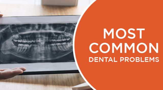 most-common-dental-problems