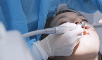 What does dental insurance cover? Dental insurance usually fully pays for preventive care such as cleanings; however, coverage goes far beyond that.
