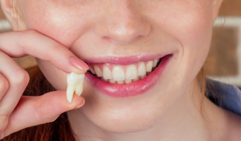Person smiling and holding a wisdom tooth.