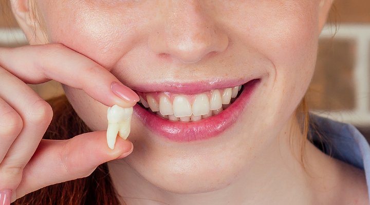 Person smiling and holding a wisdom tooth.