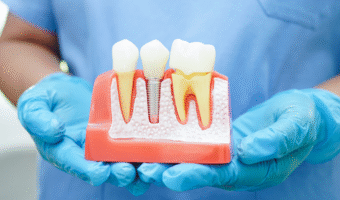 Dental professional showing how a dental implant works.