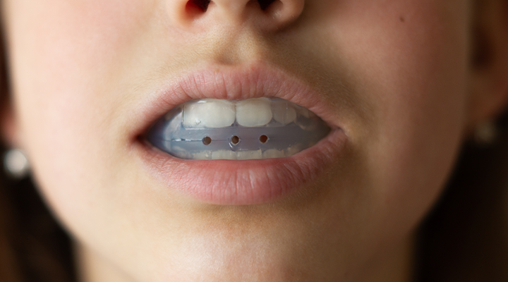 Child wearing a mouthguard.