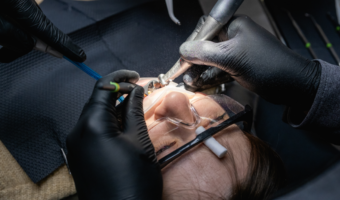 Person getting their tooth reshaped by a dentist.