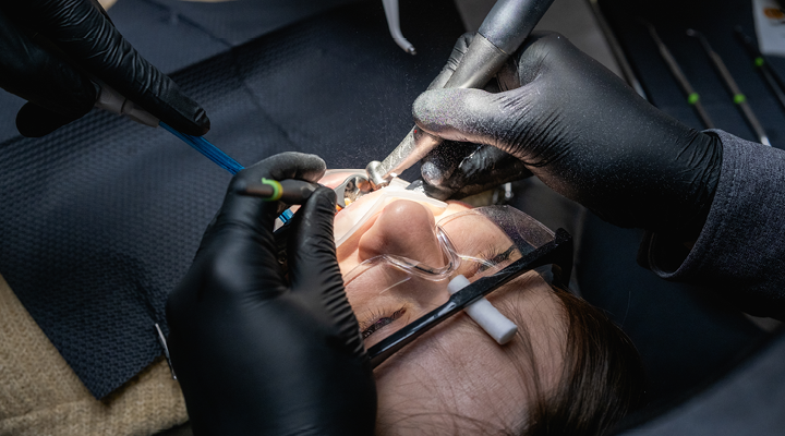 What is Tooth Reshaping?